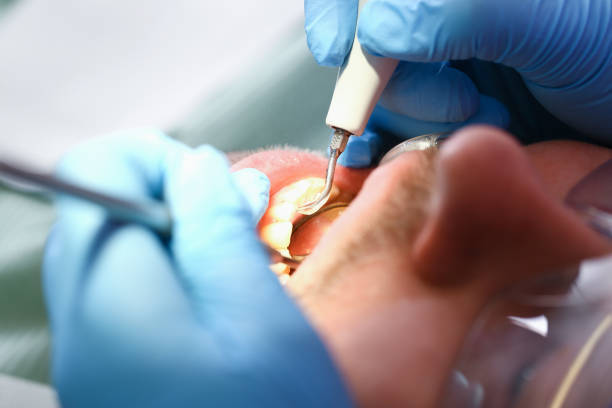 Best Teeth Whitening  in Laguna Niguel, CA