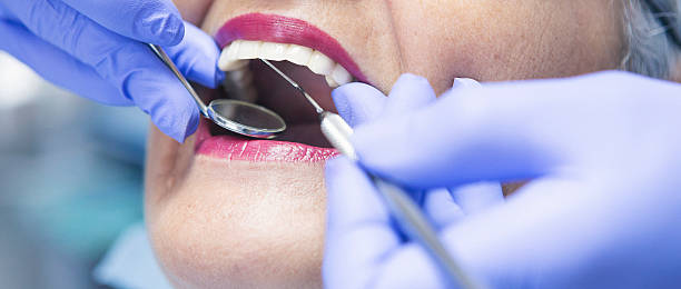 Best Cracked Tooth Emergency Dentist  in Laguna Niguel, CA